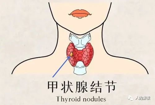 神奇的甲状腺，奥秘远超想象