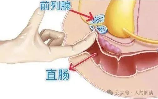 肛门的奥秘，有痣青年的福音